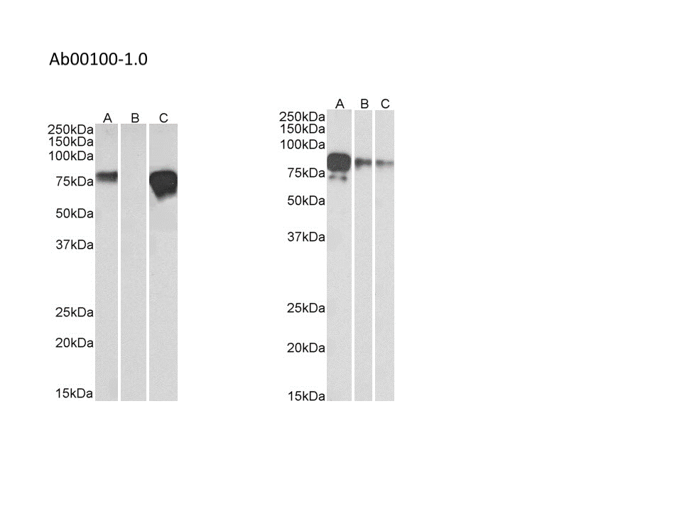 <b>Left Panel:</b> Ab00100-1.1 (2 µg/ml) staining of HEK293 spiked (A) and unspiked (B) with 5 ng multitag protein (35 µg protein in RIPA buffer). Lane C contains 25 ng purified multitag protein as positive control. <b>Right Panel:</b> Ab00100-1.0 (1 µg/ml) staining of Multitag protein at 25 ng (A), 10 ng (B) and 5 ng (C) amounts. For both, primary incubation was 1 hour. Detected by chemiluminescence.