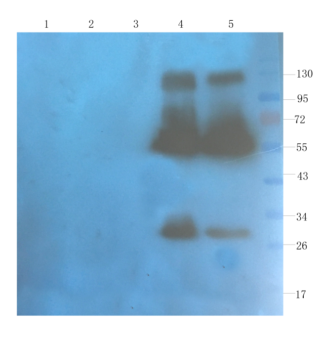 <b> Western Blot using anti-OX40L antibody Ab00447 </b>Rat spleen (lane 1), rat muscle (lane 2), rat bladder (lane 3), human breast tumour (lane 4) and human thyroid tumour (lane 5) samples were resolved on a 10% SDS PAGE gel and blots probed with Ab00447-10.0 at 1 µg/ml before being detected by a secondary antibody. The expected band size (29 kDa) is seen in the human-derived samples, as well as bands corresponding to dimers and other multimers.