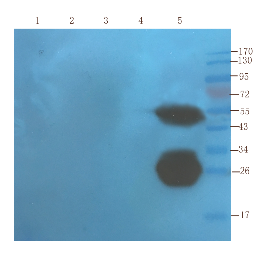 <b> Western Blot using anti-TNF alpha antibody Ab00146 </b>Mouse liver (lane 1), mouse spinal cord (lane 2), mouse testis (lane 3), mouse colon (lane 4) and human thyroid tumour (lane 5) samples were resolved on a 10% SDS PAGE gel and blots probed with Ab00146-10.0 at 1.5 µg/ml before being detected by a secondary antibody. The expected band size (26.9 kDa) is seen in the human-derived samples, as well as a band corresponding to dimers.