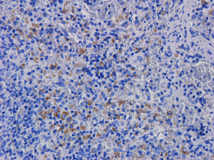 <b> Immunohistochemical staining of rat spleen tissue using anti-CD11a antibody (Ab00535) hu1124 (Efalizumab). </b> Anti-CD11a staining of formaldehyde fixed paraffin embedded rat spleen tissue, at 40x magnification. The human IgG1-chimeric version of hu1124 (Ab00535-10.0) was used to stain samples at a concentration of 3 µg/ml.