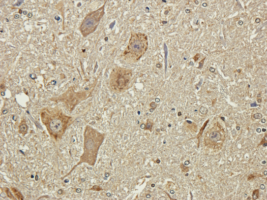 IHC image with strong staining performance